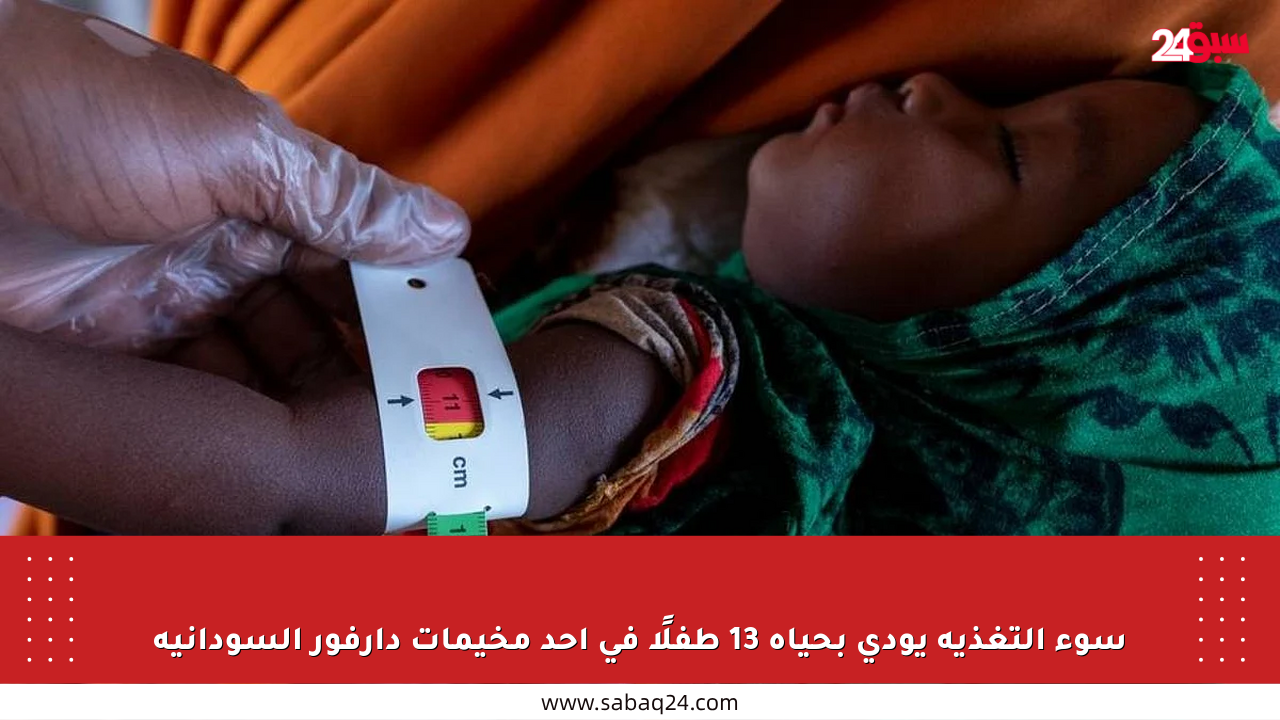 سوء التغذية يودي بحياة 13 طفلًا في أحد مخيمات دارفور السودانية